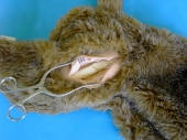 Femoral Leg Bone Fracture